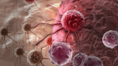 Странный блик: как по фотографии определить редкую форму рака
