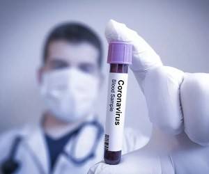 Новый «мю»-штамм коронавируса устойчив к вакцинам: нужно ли беспокоиться?
