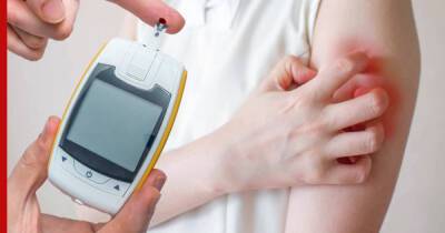 Признаки диабета: на высокий сахар в крови укажут неприятные симптомы на коже