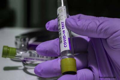 10 января в Курганской области выявлены 89 случаев заболевания коронавирусом