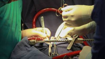 В США хирурги сделали первую в мире пересадку сердца свиньи человеку