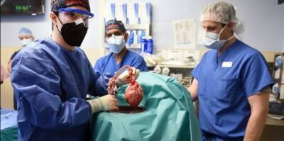 В США человеку впервые успешно пересадили сердце свиньи