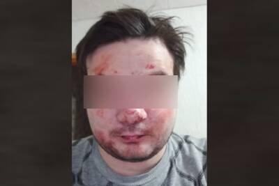 В Тверской области жестоко избитый на улице мужчина обвиняет очевидцев в равнодушии