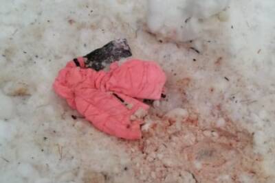 Посреди леса в Приозерском районе нашли окровавленную детскую куртку