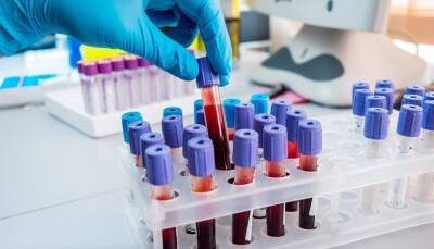 О чем говорит биохимический анализ крови