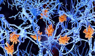 Гарвардские исследователи назвали главную причину рассеянного склероза