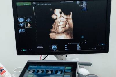 Беременные псковички теперь могут увидеть ребенка в 4D