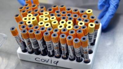 В центре имени Гамалеи рассматривают вариант создания новой вакцины от COVID