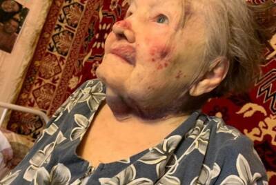 СКР завершил расследование дела об избиении 95-летней пенсионерки. Сиделке грозит колония