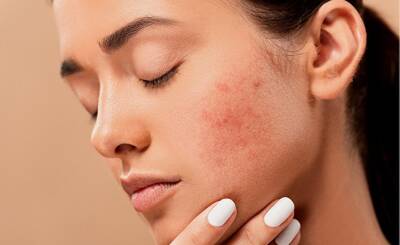 Daily Express (Великобритания): симптомы, которые могут сигнализировать о том, что у вас рак кожи
