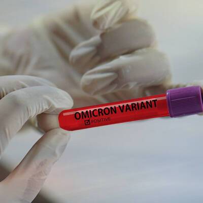 В России появилась тест-система для определения антител к омикрону
