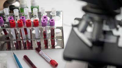 Гинцбург рассказал о разработке теста на вируснейтрализующие антитела к омикрон-штамму
