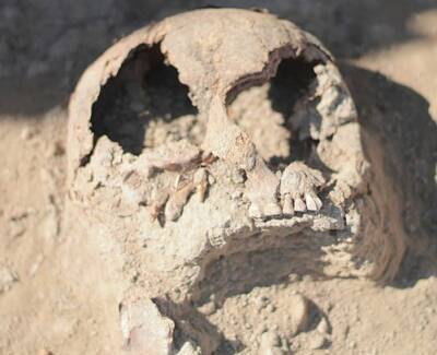 Археологи обнаружили 2000-летний череп воина с вживленной металлической пластиной