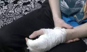 В Екатеринбурге на уроке физкультуры первоклассник получил обморожение рук
