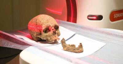 На Тернопольщине отсканировали череп, чтобы выяснить, как выглядел местный житель три тысячи лет назад