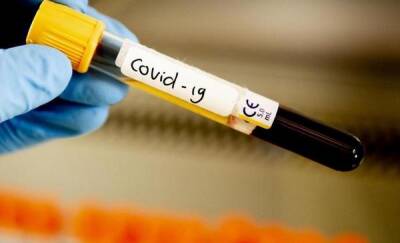 На Ямале выявили 6 случаев заражения штаммом коронавируса "омикрон"