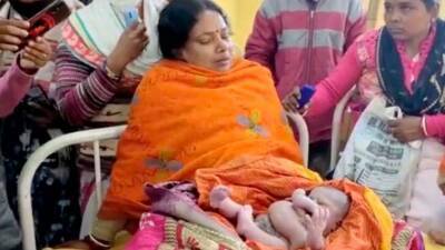 Младенец с восемью конечностями родился в Индии (фото)