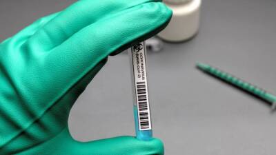 Петербургские врачи выявили 5922 случая заражения коронавирусом за сутки