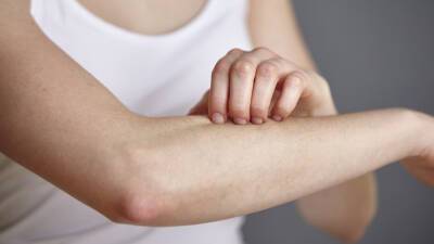 Врач Вертиева заявила, что коронавирус может привести к обострению кожных заболеваний