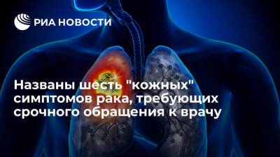 Британский врач Геррини назвала синяки, пятна и сыпь на коже симптомами рака легких - ria - Москва - Англия