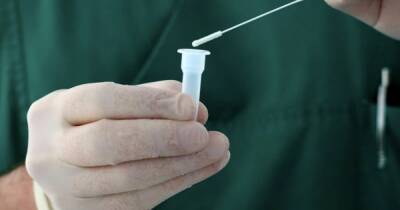В России изобрели кожный тест на коронавирус