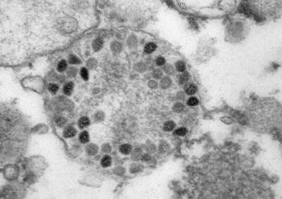 Названы пять симптомов «омикрона» у вакцинированных от коронавируса