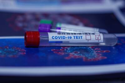 Эпидемиолог заявил о предрасположенности к омикрону людей, не болевших COVID-19