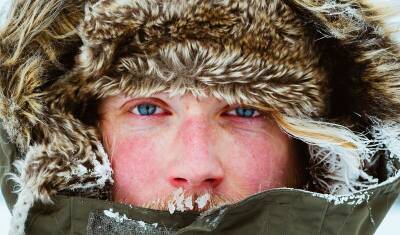 Врачи предупреждают россиян о тяжелых формах аллергии на холод