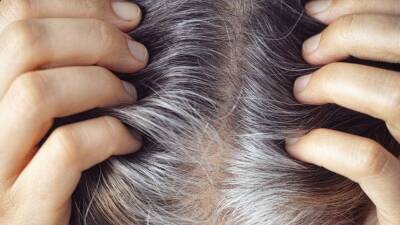 Дело не в стрессе: врач рассказала о причинах и опасности ранней седины волос