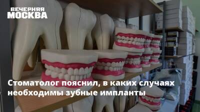 Стоматолог пояснил, в каких случаях необходимы зубные импланты