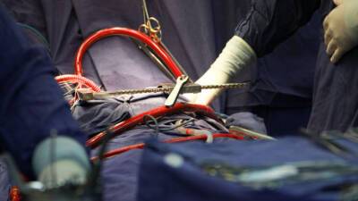 В Сургуте врачи спасли руку пациента, пришив ее к животу