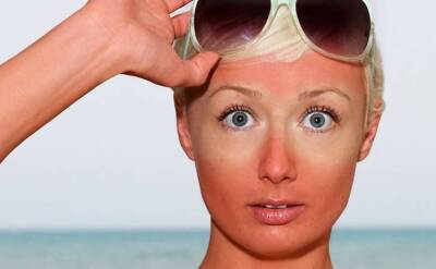 Учеными развенчан миф о том, что солнце способствует старению кожи