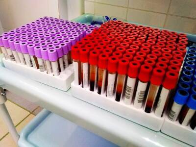 Биолог рассказала, обладатели какой группы крови имеют высокий риск заболеть COVID-19