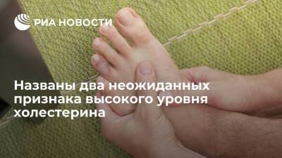 The Sun: состояние ногтей на ногах и кожи могут говорить о повышенном холестерине - ria.ru - Москва - Англия