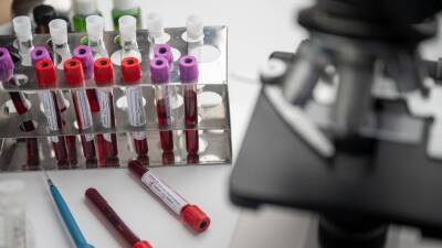 Epidemic: пациенты с первой группой крови более активно распространяют COVID-19