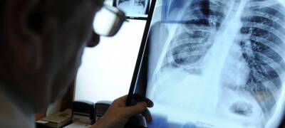 Уровень заболеваемости внебольничной пневмонией в Карелии резко пошел на спад