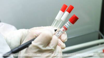 В Чехии выявили первый случай заражения штаммом коронавируса В.1.640