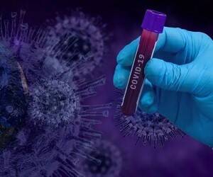 Во Франции нашли новый штамм коронавируса с почти полусотней мутаций