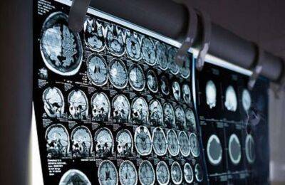 Вчені виявили нову важливу функцію однієї з частин людського мозку