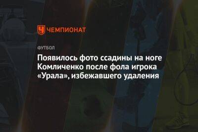 Появилось фото ссадины на ноге Комличенко после фола игрока «Урала», избежавшего удаления