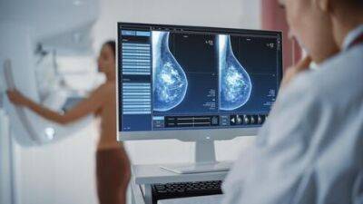 Где в Израиле больше шансов вылечиться от рака груди