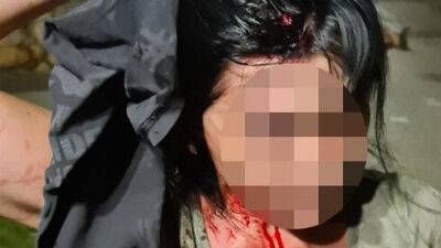 Репатриантку в Бат-Яме избили на детской площадке, полиция: "Увидите их еще раз - звоните"