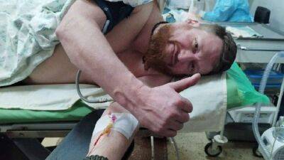 "Стрелял Пушилин": в сети высмеяли ранение "военкора" Пегова после его фото с террористом