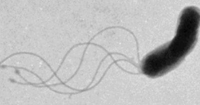 Маленькие Карлсоны с пропеллерами. Ученые разгадали загадку движения бактерий, на это ушло 50 лет - focus.ua - Украина