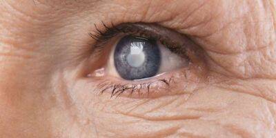 Вчені розробили новий метод раннього виявлення глаукоми