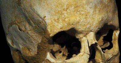 Дело рук мистиков или обычных врачей. Что не так с 2300-летним черепом, который нашли в Турции