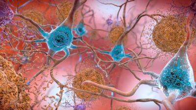 В США представлен новый препарат для замедления развития Альцгеймера