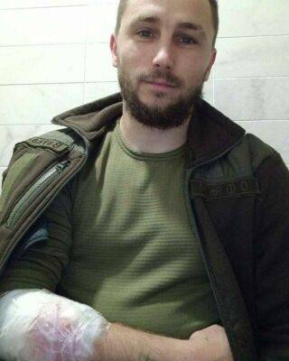 Денис Урбанович опубликовал свое фото после ранения