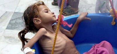 ЮНИСЕФ: более 11 000 детей были убиты или искалечены во время гражданской войны в Йемене - unn.com.ua - Украина - Киев - Иран - Саудовская Аравия - Йемен
