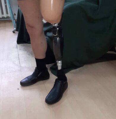 В Твери потерявшему ногу человеку сделали протез за 3,5 млн рублей